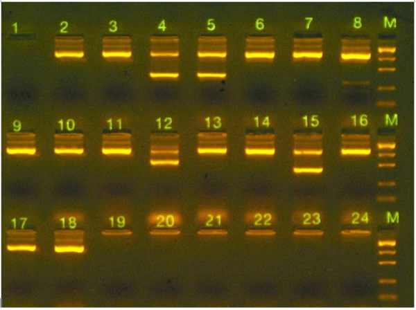 Oragene DNA gel